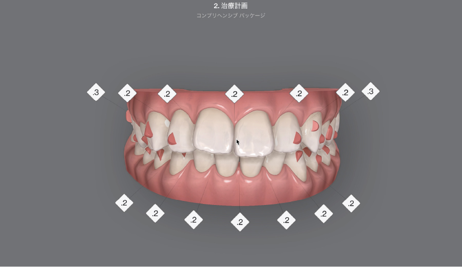 D無料シミュレーション