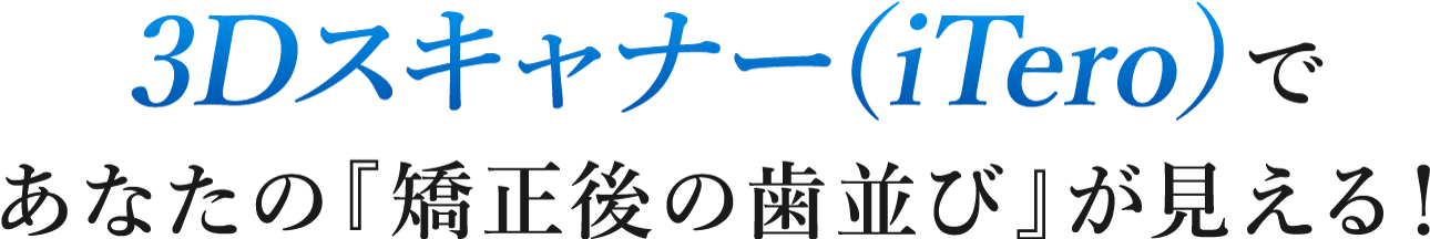最新の3Dスキャナー(iTero)であなたの「矯正後の歯並び」が見える